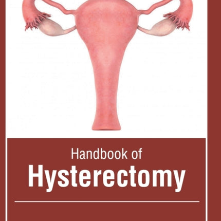 Handbook of Hysterectomy