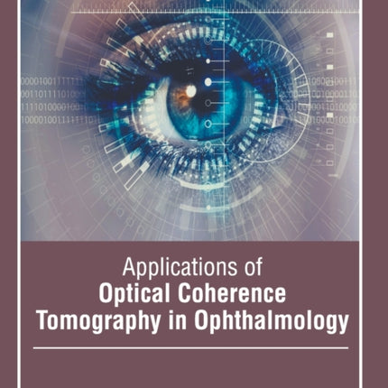 Applications of Optical Coherence Tomography in Ophthalmology