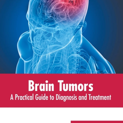 Brain Tumors: A Practical Guide to Diagnosis and