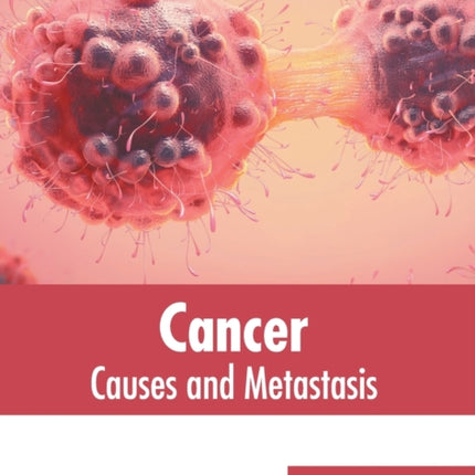 Cancer: Causes and Metastasis