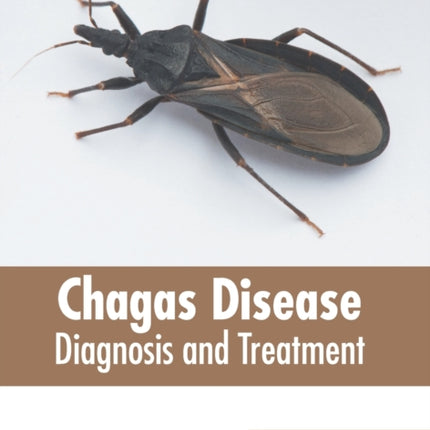 Chagas Disease: Diagnosis and Treatment