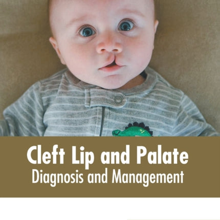 Cleft Lip and Palate: Diagnosis and Management