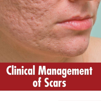 Clinical Management of Scars