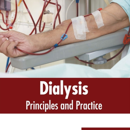 Dialysis: Principles and Practice