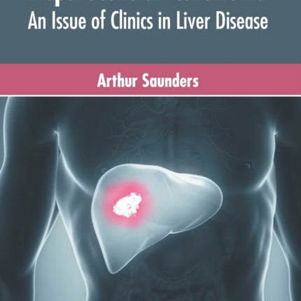 Hepatocellular Carcinoma: An Issue of Clinics in Liver Disease