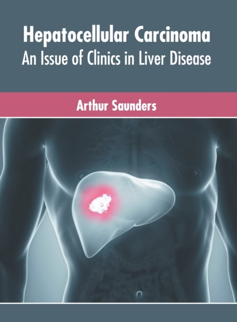 Hepatocellular Carcinoma: An Issue of Clinics in Liver Disease