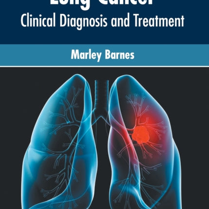 Lung Cancer: Clinical Diagnosis and Treatment