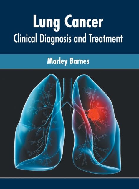 Lung Cancer: Clinical Diagnosis and Treatment