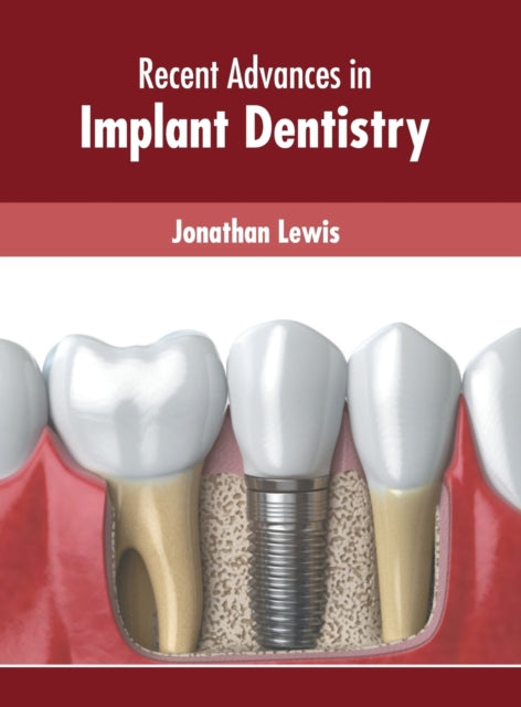 Recent Advances in Implant Dentistry