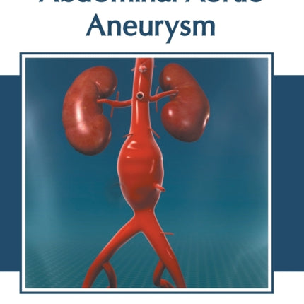 Abdominal Aortic Aneurysm