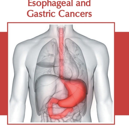 Advances in Esophageal and Gastric Cancers