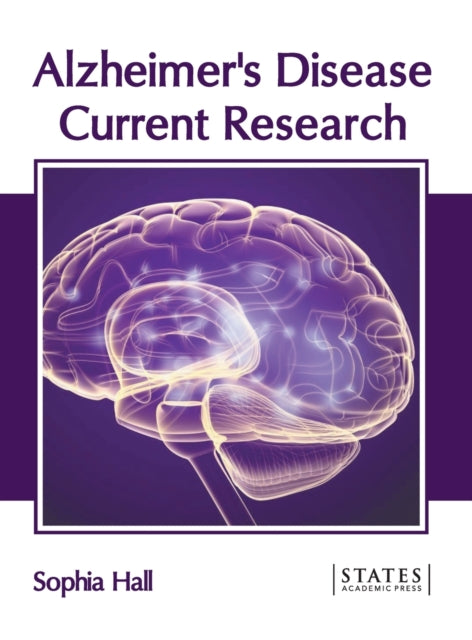 Alzheimer's Disease: Current Research