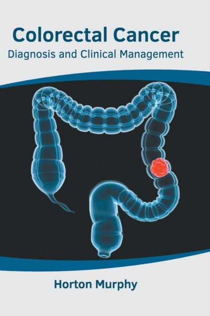 Colorectal Cancer: Diagnosis and Clinical Management