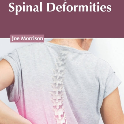 Modern Management of Spinal Deformities