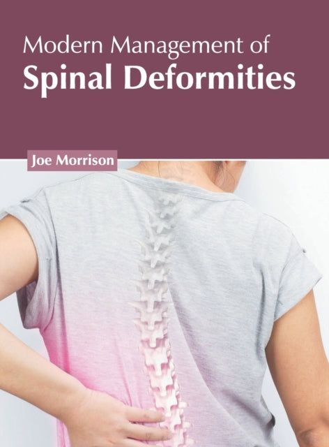 Modern Management of Spinal Deformities