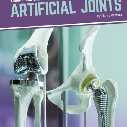 Engineering the Human Body: Artificial Joints