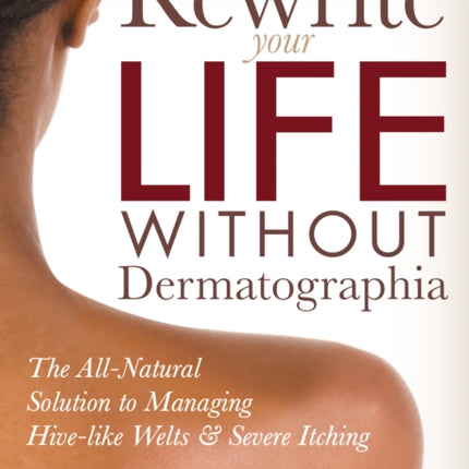 Rewrite Your Life Without Dermatographia: The