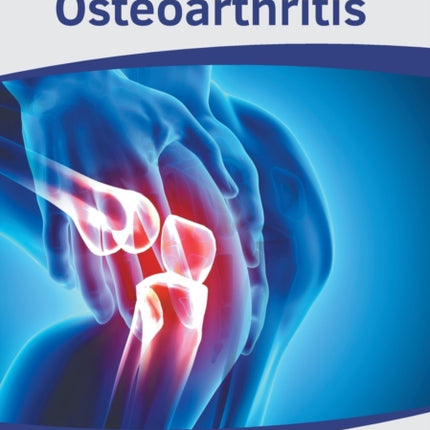 A Clinical Guide to Osteoarthritis