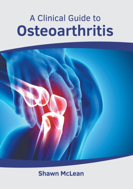 A Clinical Guide to Osteoarthritis