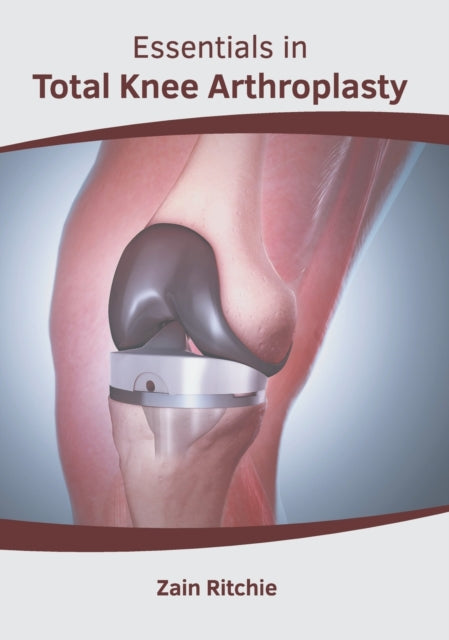 Essentials in Total Knee Arthroplasty