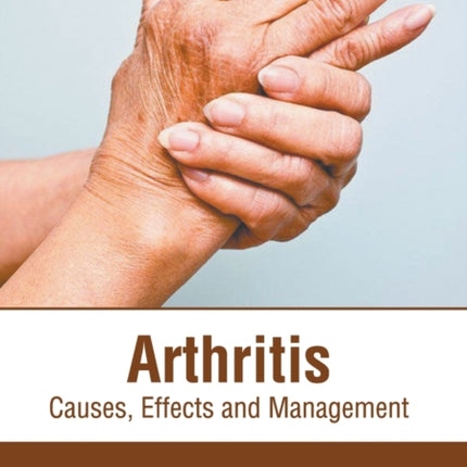 Arthritis: Causes, Effects and Management