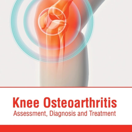 Knee Osteoarthritis: Assessment, Diagnosis and Treatment