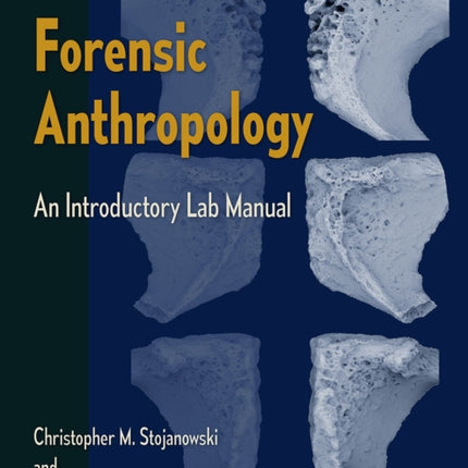 Forensic Anthropology: An Introductory Lab Manual