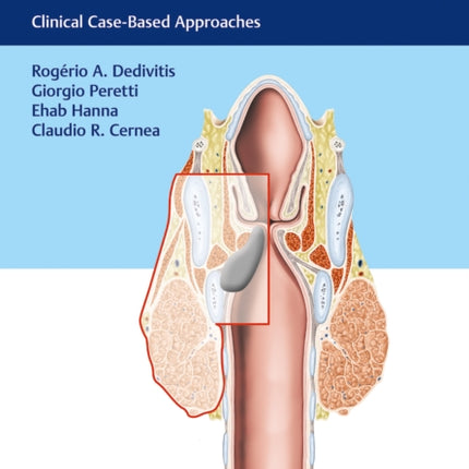 Laryngeal Cancer