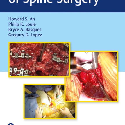 Video Atlas of Spine Surgery