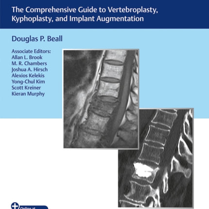 Vertebral Augmentation