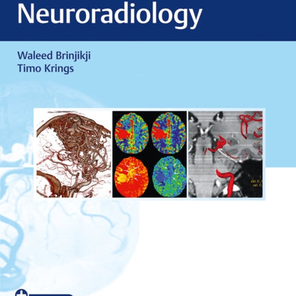 Imaging in Neurovascular Disease