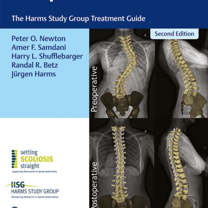 Idiopathic Scoliosis: The Harms Study Group Treatment Guide