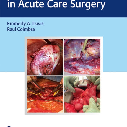 Surgical Decision Making in Acute Care Surgery