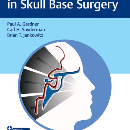 Vascular Challenges in Skull Base Surgery