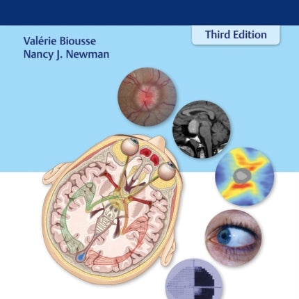 NeuroOphthalmology Illustrated