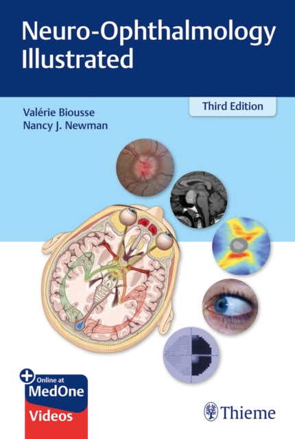 NeuroOphthalmology Illustrated