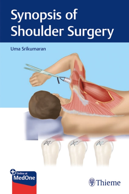 Synopsis of Shoulder Surgery