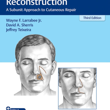 Principles of Facial Reconstruction