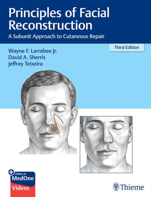 Principles of Facial Reconstruction