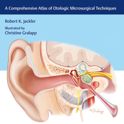 Ear Surgery Illustrated: A Comprehensive Atlas of Otologic Microsurgical Techniques