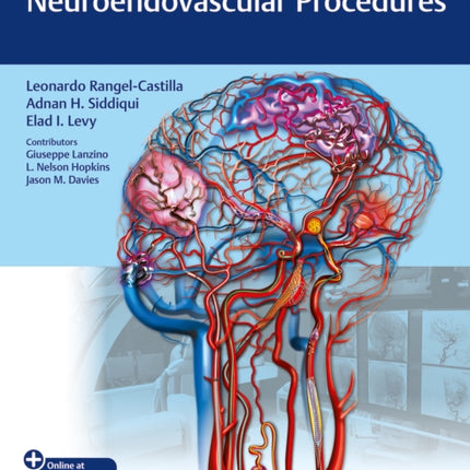 Video Atlas of Neuroendovascular Procedures