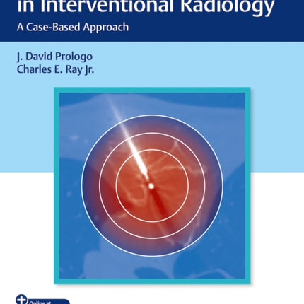 Advanced Pain Management in Interventional Radiology