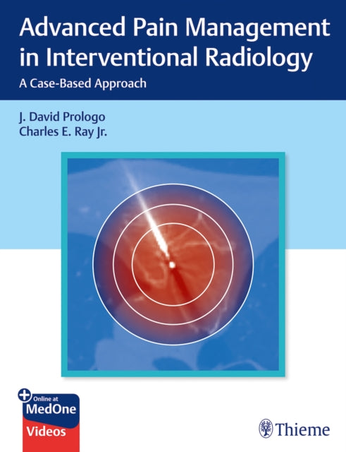 Advanced Pain Management in Interventional Radiology