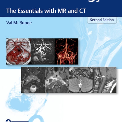 Neuroradiology
