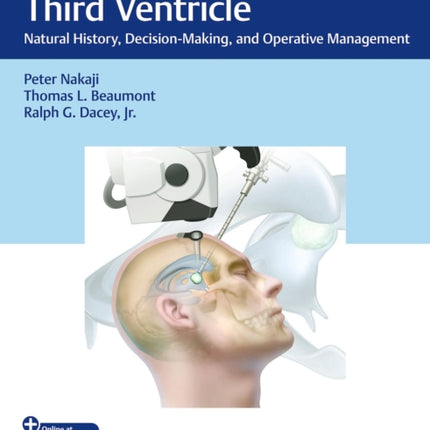 Colloid Cysts of the Third Ventricle