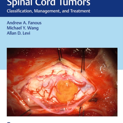 Spine and Spinal Cord Tumors  Classification Management and Treatment