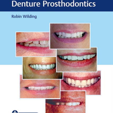 Case Guides to Complete and Partial Denture Prosthodontics