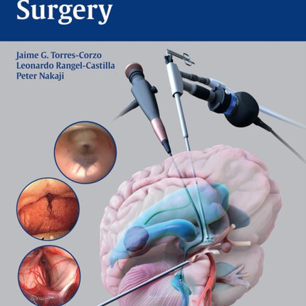 Neuroendoscopic Surgery