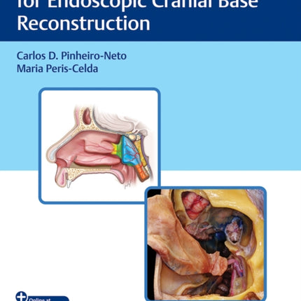 Techniques and Key Points for Endoscopic Cranial Base Reconstruction