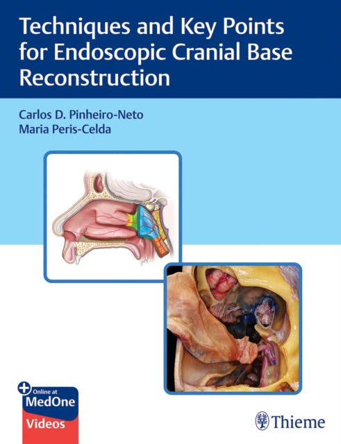 Techniques and Key Points for Endoscopic Cranial Base Reconstruction